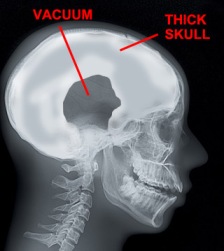 FULL YET EMPTY: Head scan of a rempit sample
